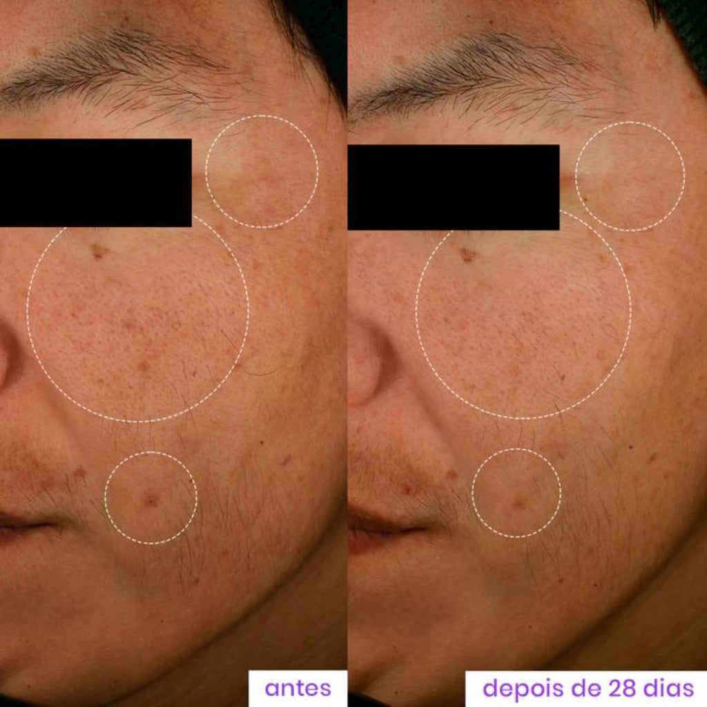 Sérum Facial Super Niacinamida 20% 30ml Sallve